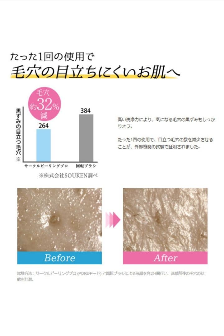 ヤーマン　サークルピーリング　プロ　毛穴