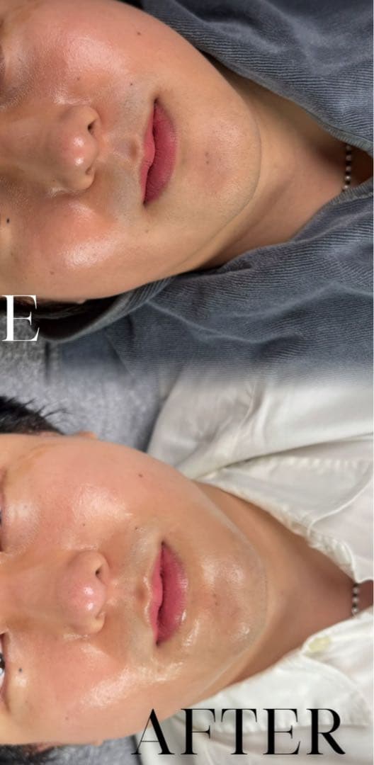 効果実証済　業務用美容機器LDM 水玉リフティング　超音波美肌マシン