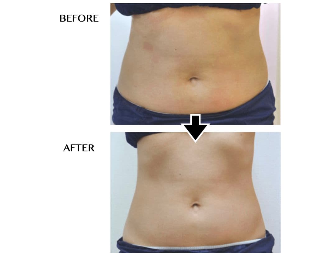 CELLZERO FAST 美容機器